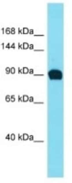 EFR3B Rabbit anti-Human, Polyclonal, Novus Biologicals 100 &mu;g | Buy Online | Novus Biologicals | Fisher Scientific